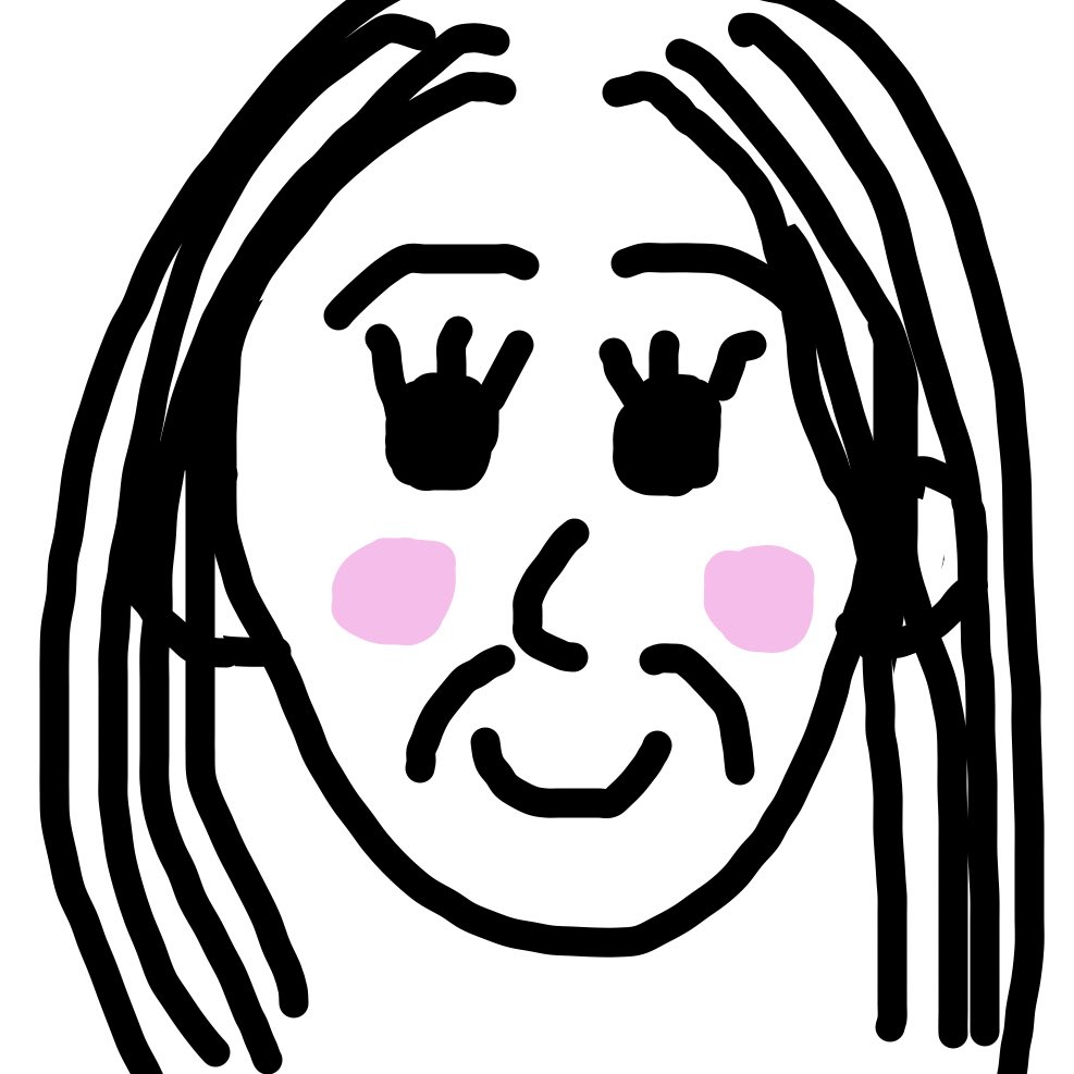 katarina_rost's tweet photo. メーラーファット除去ってよく理解してなかったんだけど笑った時に頬の横に出る線を消す手術なの？
私はその線が欲しくて脂肪移植しようとしてるんだが、、
整形は自己満だからアレだけどみんな無い物ねだり😭
ほうれい線と違って可愛いのに！
1枚目線あり2枚目なし3枚目ほうれい線
違いわかりますか！ https://t.co/JW5mCJjP97