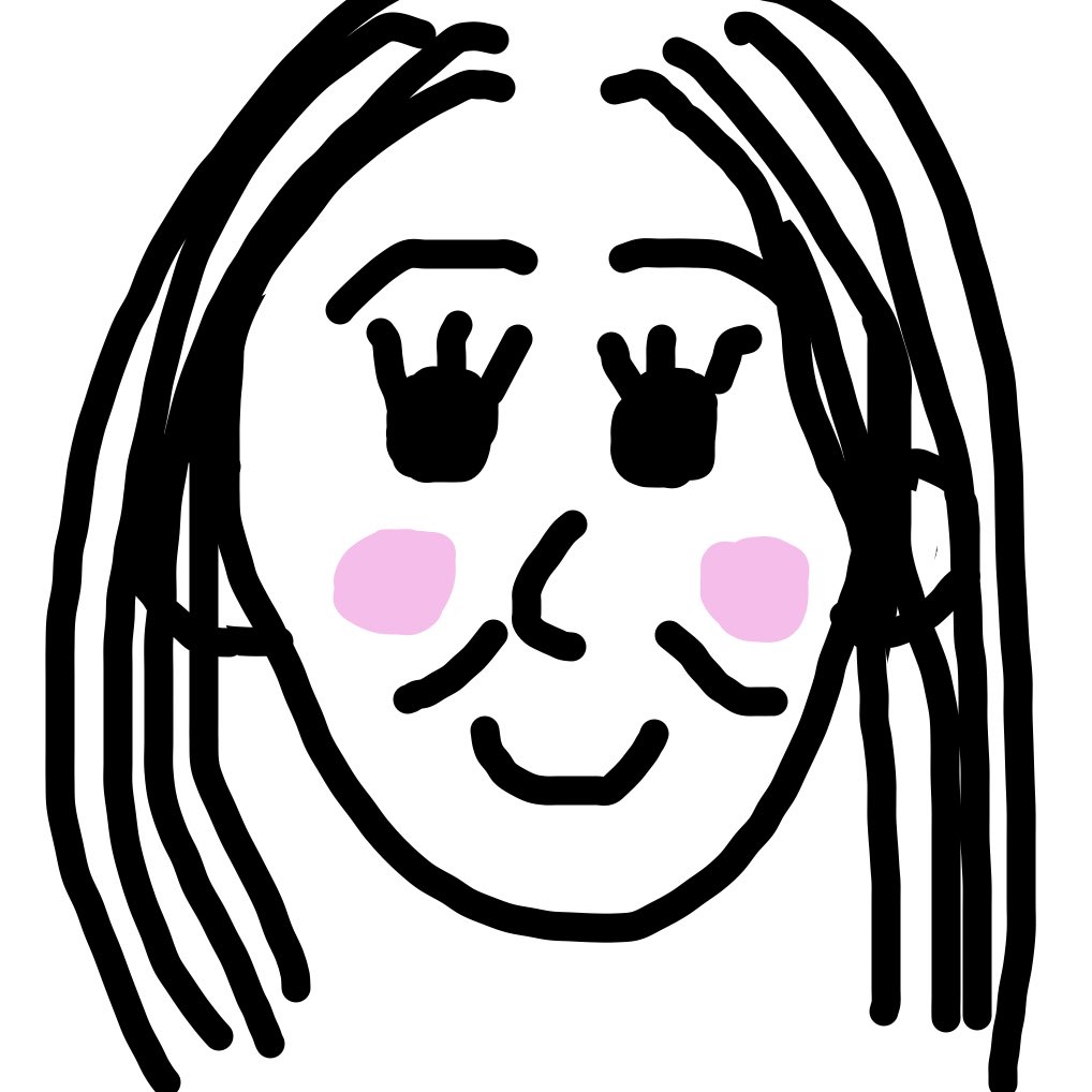 katarina_rost's tweet photo. メーラーファット除去ってよく理解してなかったんだけど笑った時に頬の横に出る線を消す手術なの？
私はその線が欲しくて脂肪移植しようとしてるんだが、、
整形は自己満だからアレだけどみんな無い物ねだり😭
ほうれい線と違って可愛いのに！
1枚目線あり2枚目なし3枚目ほうれい線
違いわかりますか！ https://t.co/JW5mCJjP97