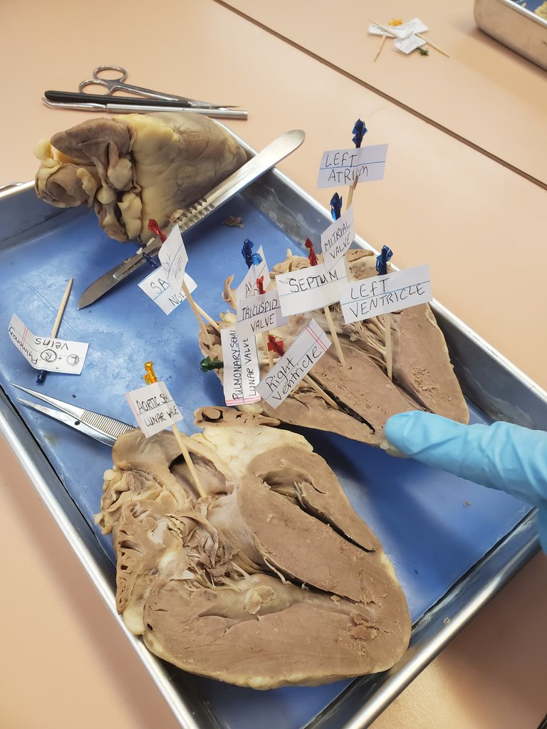 TaraVatNAC's tweet image. Using @GetKahoot to review our #heartdissection today #NACnursing #ForTheLoveOfScience ♡♡♡ #HigherEd @NunavutCollege #BScN in #Iqaluit #Nunavut #Canada