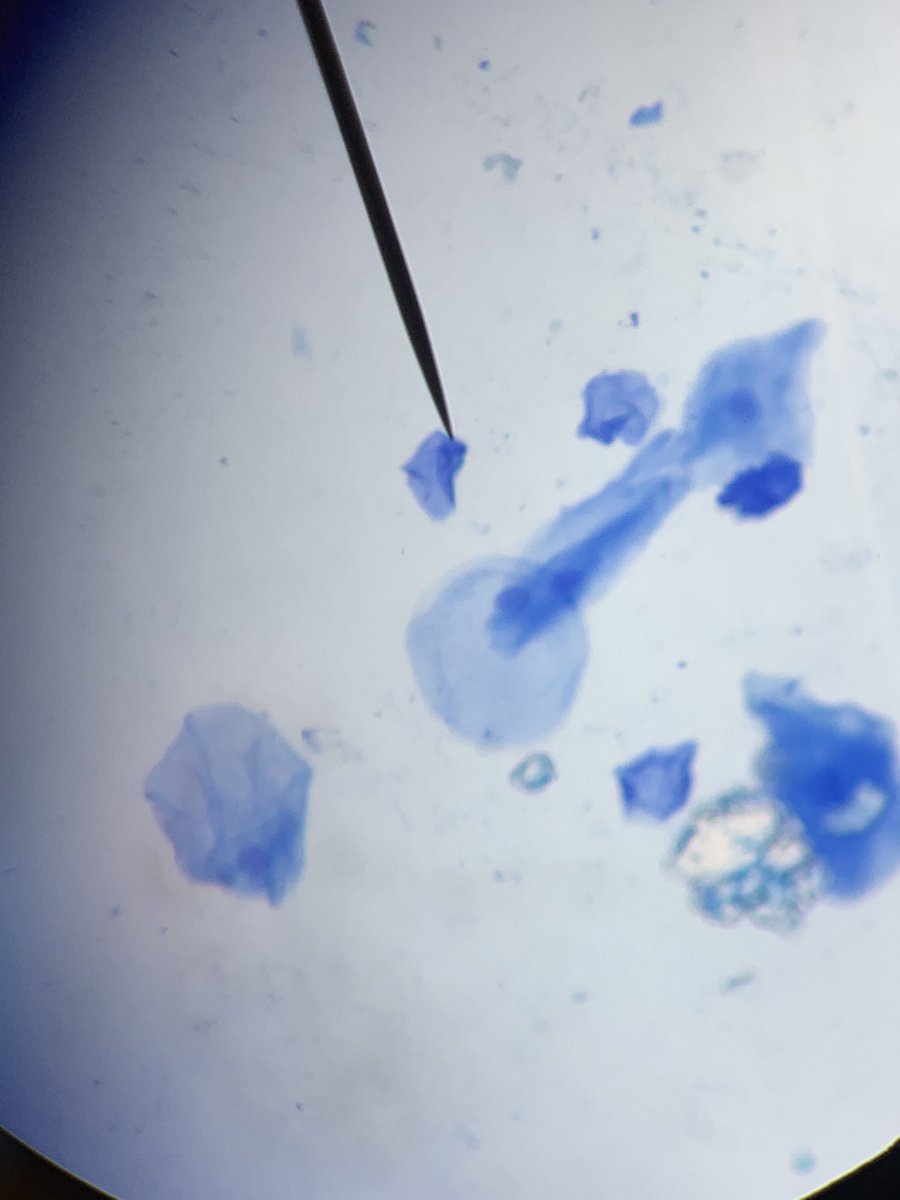 JackHigginbot11's tweet photo. My partner and I thought looking at our own cheek cells and being able to see their nuclei was super neat. @UNKBiol106AC #106Week4ACS20 https://t.co/GXsblItZAL