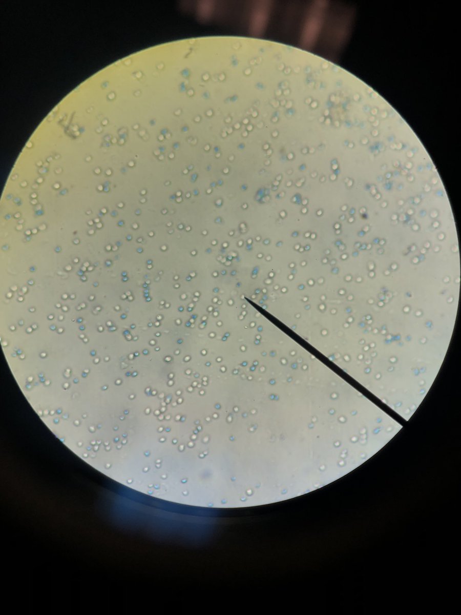 Jessica27555291's tweet photo. Got yeast? #UNKBiol106AC
#106Week4ACS20 https://t.co/tKtcDPGjpn