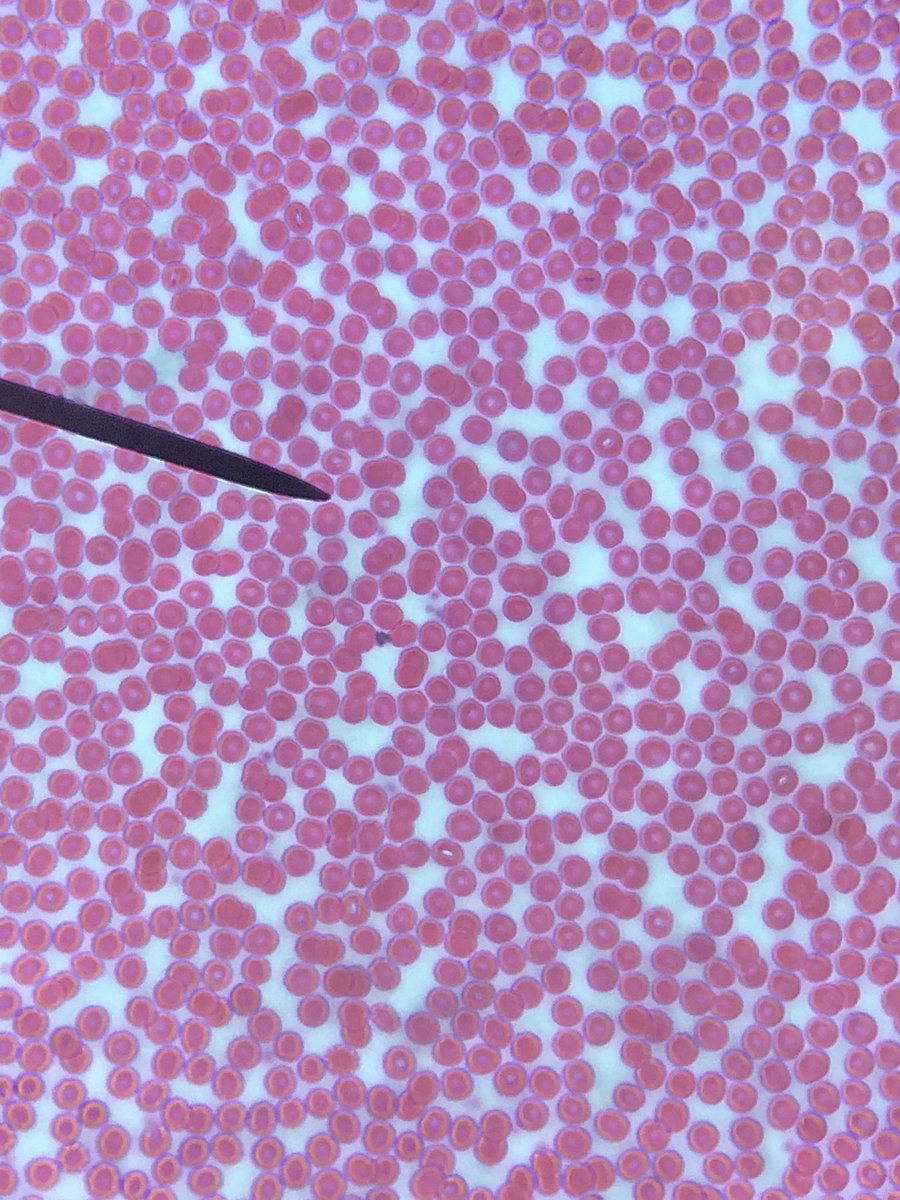 MsBlandford's tweet photo. the look when you realize you're looking at REAL human blood, lung (both below), stomach, and skin cells under the microscope, all to figure out why humans can't produce our own food
*because we don't have chloroplast- the organelle in plant cells (below) that does photosynthesis https://t.co/fd9RHWrjYv