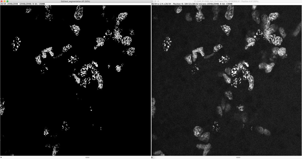 3D confocal stack of EdU+ nuclei - segmentation left, original stack right