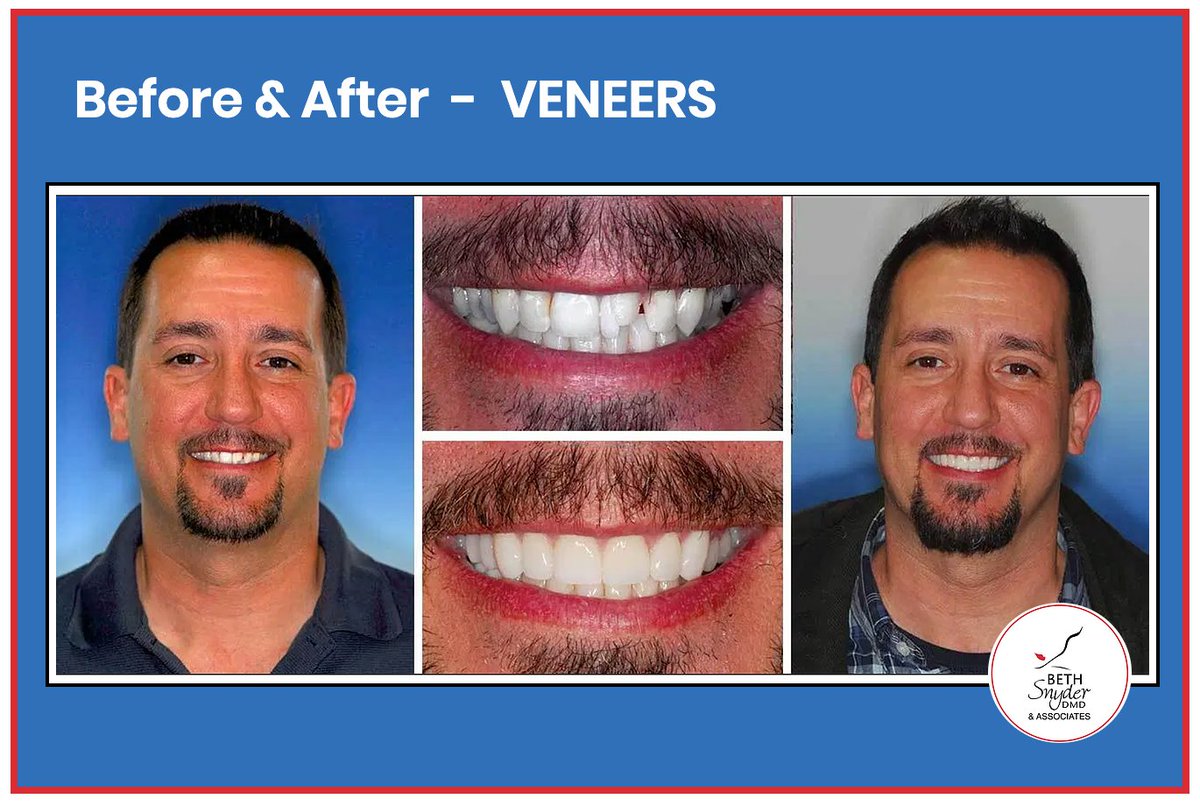 bethsnyderdmd's tweet image. Could your smile use some TLC? 
Find Your Beautiful Smile Today!

Your ideal look is about more than just a straight smile.
#BethSnyderDMD combines extensive expertise, with a passion for functionality and aesthetics. 

Contact us today for a little... #SMILETLC #SmileExpert