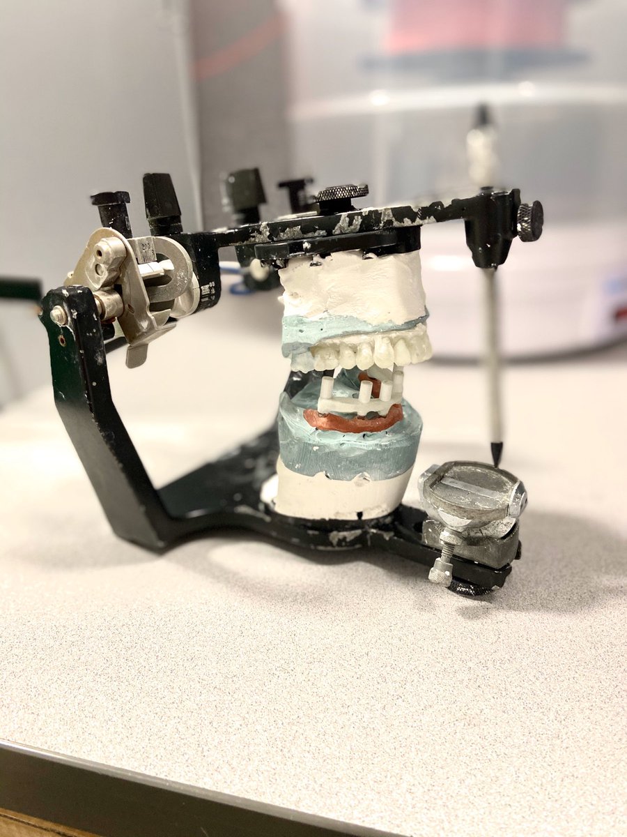 CornerstoneDL's tweet photo. Implant Model with Soft-Tissue. Hybrid, printed #zirconia verification jig 👈🏻to ensure optimum passive seat for final restoration made with authentic #straumann parts 🔥🔥 https://t.co/pFdnmqz0H8