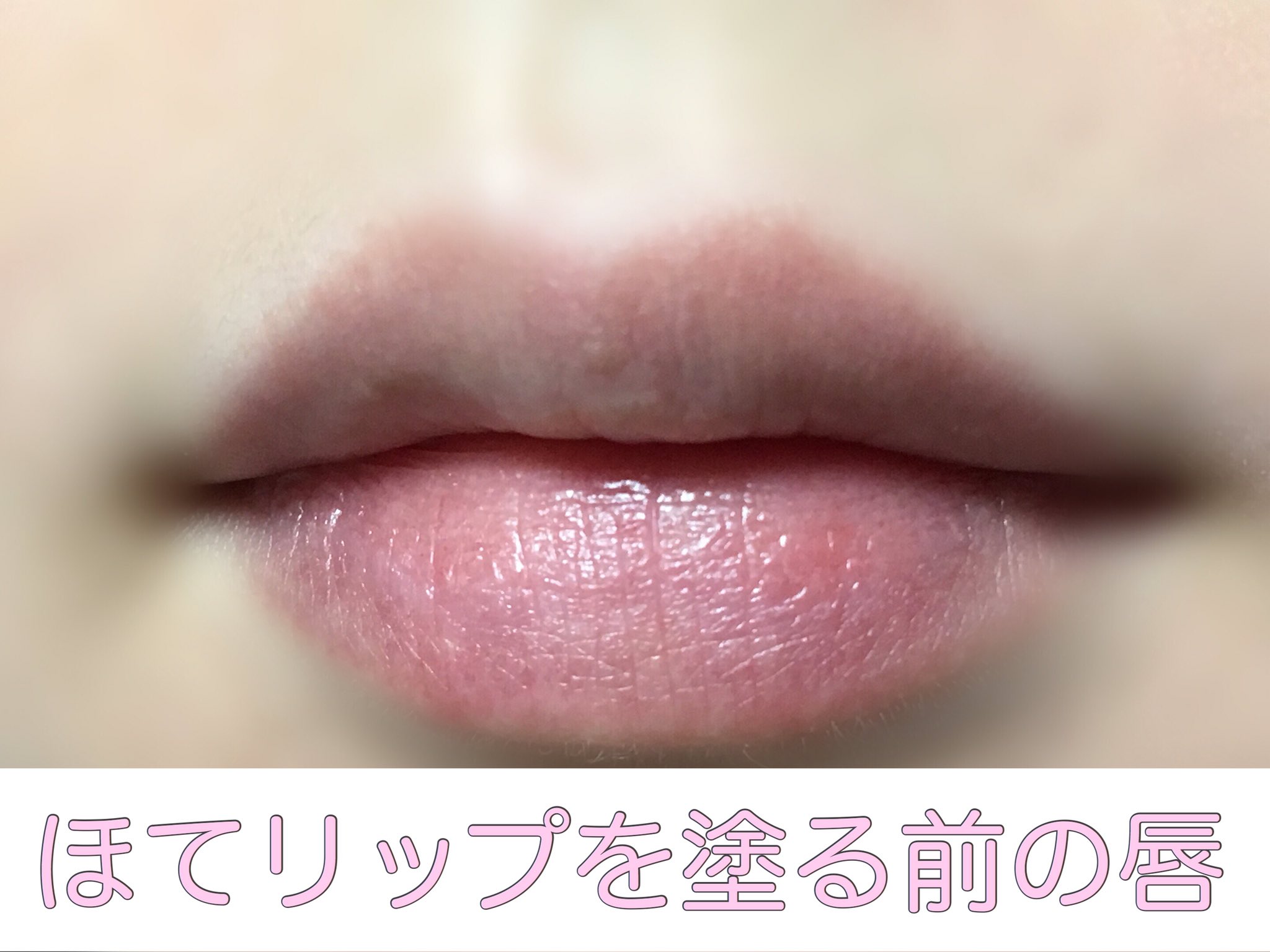 ご醜傷様ちゃん エテュセのほてリップのピンク 昨日発売なのに売り切れ続出だった 唇の乾燥や縦ジワが無くなるし 赤ちゃん みたいな唇になってめちゃめちゃ可愛い 赤も使ったことあるけど 薄い唇の私でもちゃんとぷっくりするのがやっぱり凄い