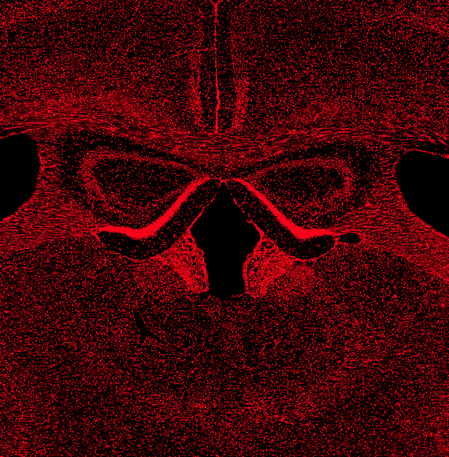 SinaiBrain's tweet image. A SHORT TIME AGO, IN A LAB NOT THAT FAR FAR AWAY… @Shal3 creates “Darth Matter”: #Nuclei from the adult murine #hippocampus imaged using #DAPI! VOTE NOW for "Art of the Brain" image #48. Most♥️s wins! @MountSinaiNeuro @LabFriedel #ZouLab @MtSinaiPostdocs