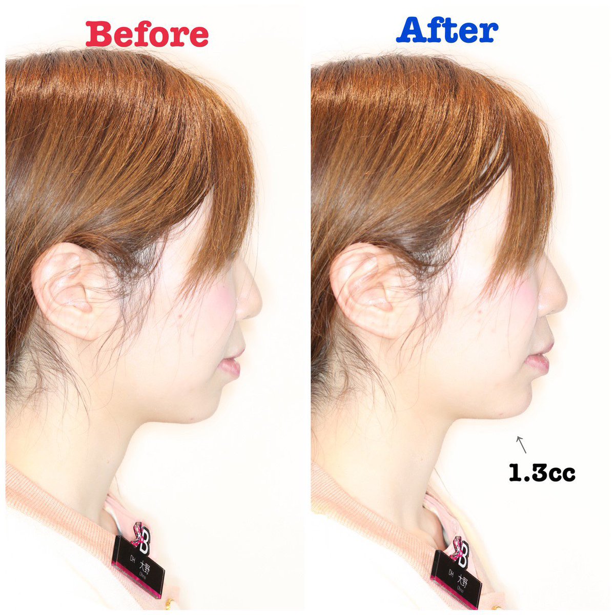 顎ヒアル بحث في تويتر