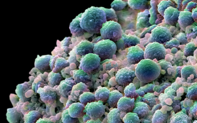 Where could we be going wrong in treating #ProstateCancer? How do we get better at it?👩‍⚕️

Find answers to these questions in latest #research by India Alliance fellow <a href="/bushraiitk/">Bushra Ateeq</a> at <a href="/IITKanpur/">IIT Kanpur</a> 👩‍🔬

Research summary🔗 indiaalliance.org/news/384

✍️@kirangurung29 for <a href="/SciResMatters/">Research Matters</a>