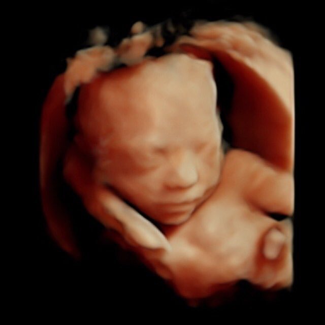 JessieAndCo_'s tweet photo. πJust wanted to share this gorgeous photo of my grand daughter who Iβll get to meet in 11 weeks (ish π€£)! I cannot wait to be Nannie Lou π #nannytobe #BabyShack #cantwait https://t.co/YuaCs9mleB