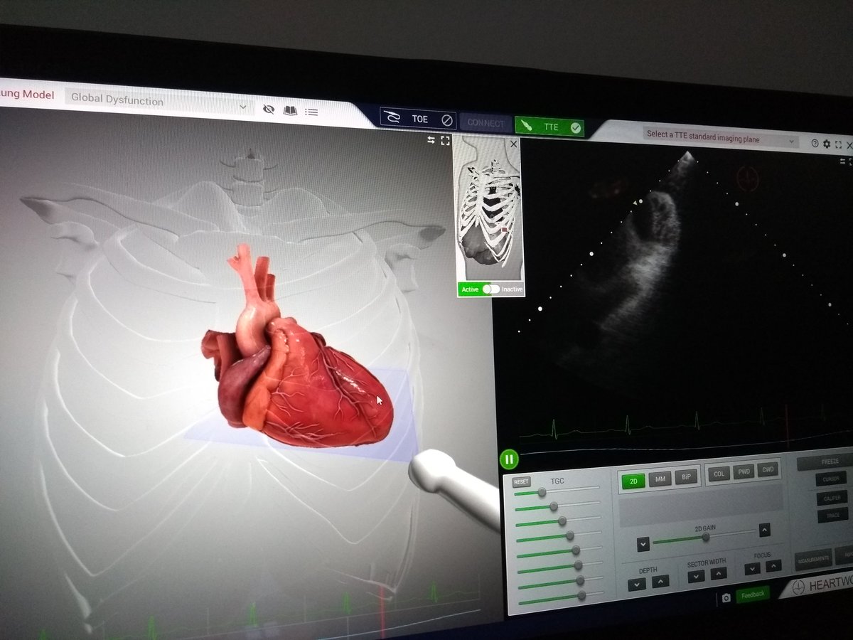 Sim_ALS's tweet photo. Amazing piece of kit! #Simulator 'Eve' from @Heartworks @SmarterScanning really helping with understanding what tilting, sliding, rocking or lifting does to your picture!

Echocardiography for FICE &amp; FUSIC #SITRUS 

#simulationrocks
#POCUS
#SimFellow

@SitrusUK https://t.co/BkdGHIRzEN