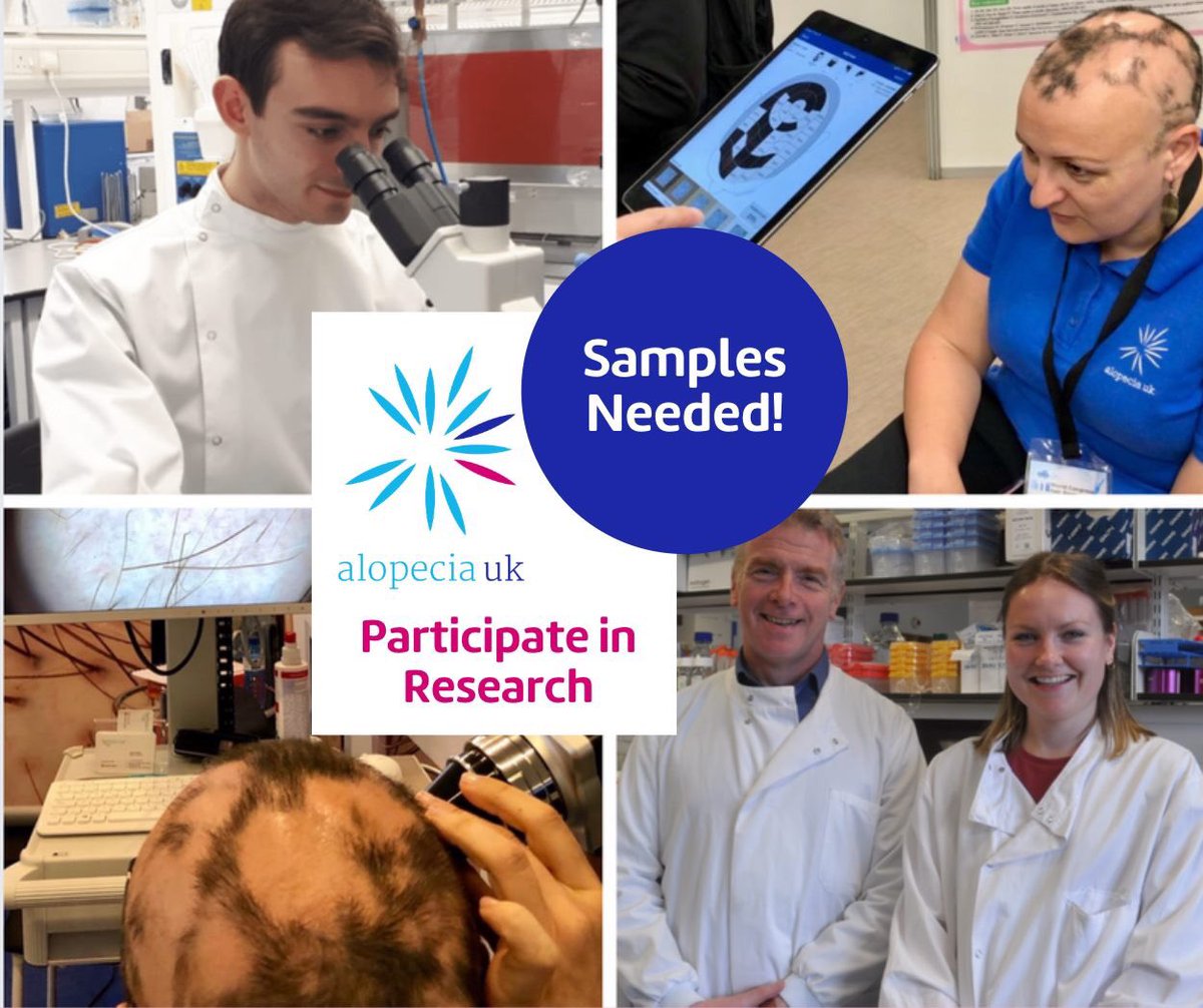 Researchers in Glasgow (Scotland) and Bradford (West Yorkshire) are looking for patients with alopecia areata to provide samples to be used in research studies. Full details here: alopecia.org.uk/participate-in… #alopecia #alopeciaresearch
