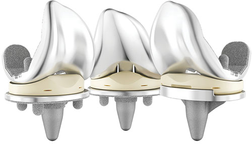 Can Technology Help @DePuySynthes  Close the Gap in Their Knee Franchise? bit.ly/2TSfABj