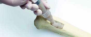 polaris_mrc's tweet image. #Bone_Grafts &amp;amp; Substitutes Market Size Worth $4.15 Billion By 2026 | CAGR: 4.81%
Read More@ bit.ly/30vOYrd
#Synthetic #Spinal_Fusion #Craniomaxillofacial #Long_Bone #size #share #trends #growth