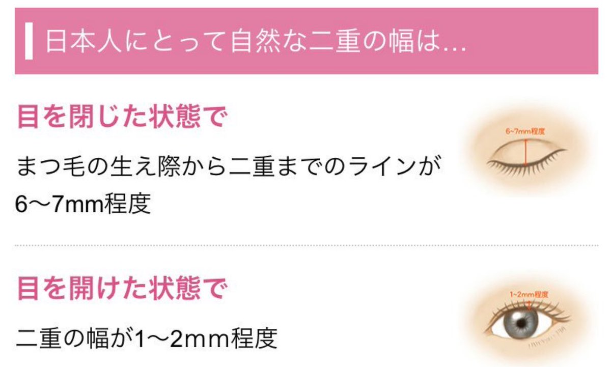 Ella 目頭眉下dt Ellarkof Twitter Ella 目頭眉下dt Ellarkof Twitter
