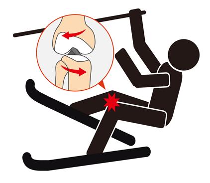 스키장에서 꽈당...손목-무릎 특히 주의해야  naver.me/G9Ag4dLk