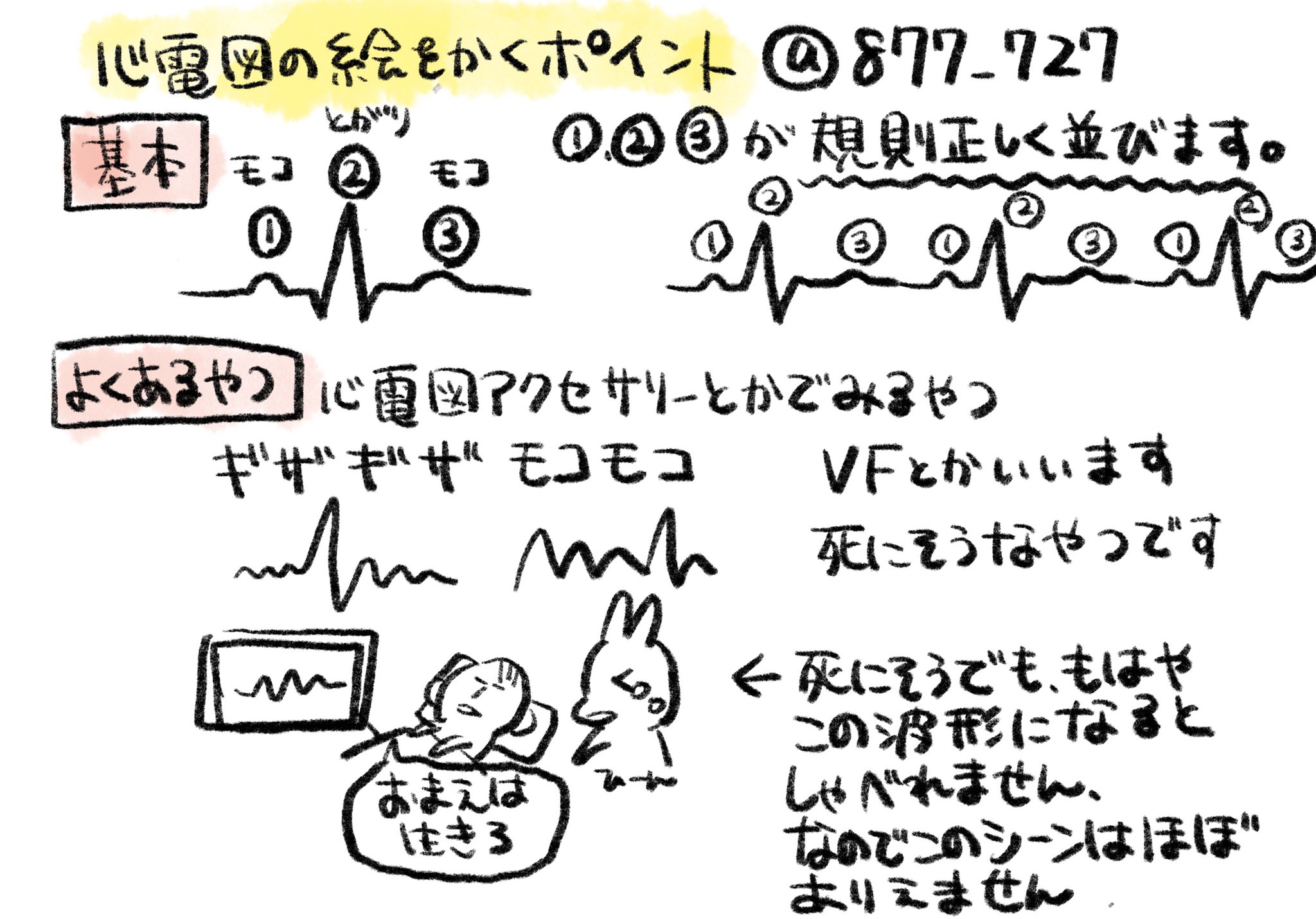 看護師のかげさん イラスト看護帖書籍化 心電図の描き方のポイント よくいう あなたは生きて みたいなシーンはだんだん一直線になるような波形にしがちですが 喋れなくなってからだんだん一直線になります そしてだいたい機械が ピピピピ と鳴り