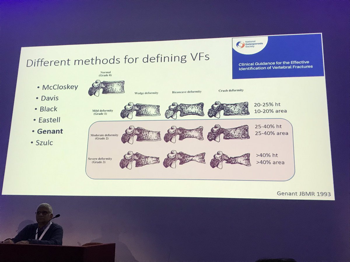 RoyalOsteoPro's tweet photo. Today our @OsteoRadJill and clinical colleague @JavaidKassim are representing the charity @BIR_News Artificial Intelligence in Radiology conference discussing the potential of AI in vertebral fracture identification . https://t.co/t863dSF4Re