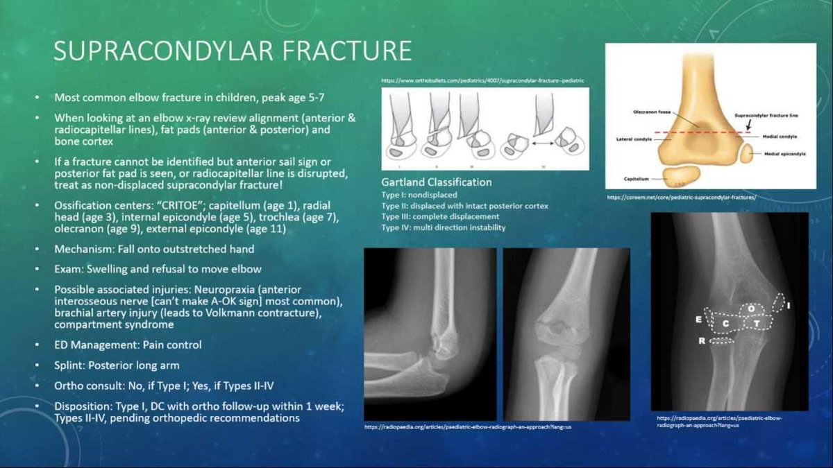 non displaced supracondylar fractures treatments for diabetes