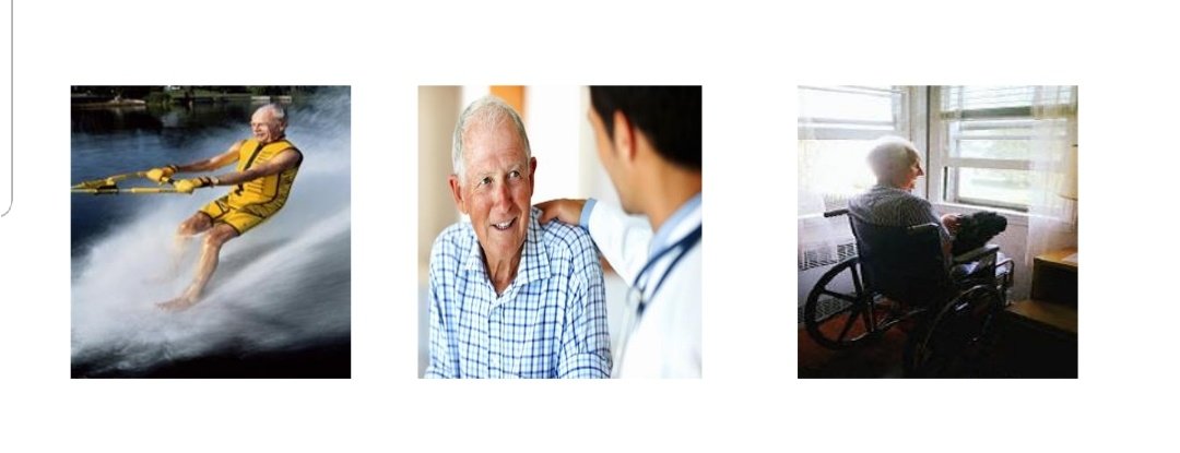 GeriOncologist's tweet photo. If at the End of "Curative" Cancer Treatment, Pt on the Left Changes to Pt on the Right, We have Failed. 

#gerionc #gerisurgonc https://t.co/u0Obo4cmfp
