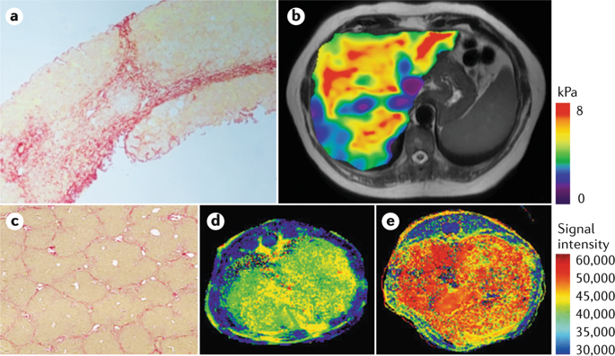 Nature Reviews Gastroenterology & Hepatology tweet media