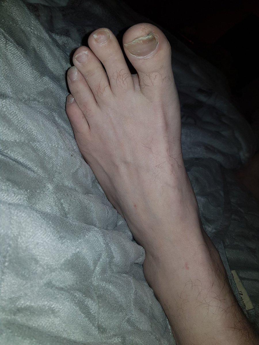 Sven43343007's tweet photo. Los ihr Fotzen!
Riecht meine Füße und fresst meine Hornhaut!
Bezahlt für den Anblick!
Schön sauber lecken.
#Foot
#Alpha
#Dom
#Cashmaster
#Footslave
#zahlschwein
#Loser https://t.co/c4mDHobEx6
