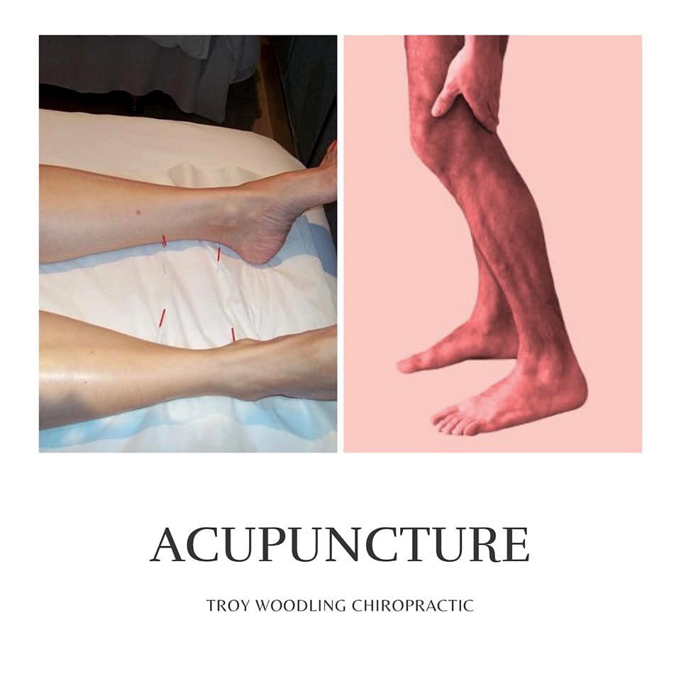 TroyWoodling's tweet photo. Muscle spasms and strains affect nearly everyone at some point in their lives. If your spasms and strains are consistent and painful, you don’t have to suffer. Our acupuncture service releases your pain by targeting the spasms using thin needles. https://t.co/jdYWt508gK