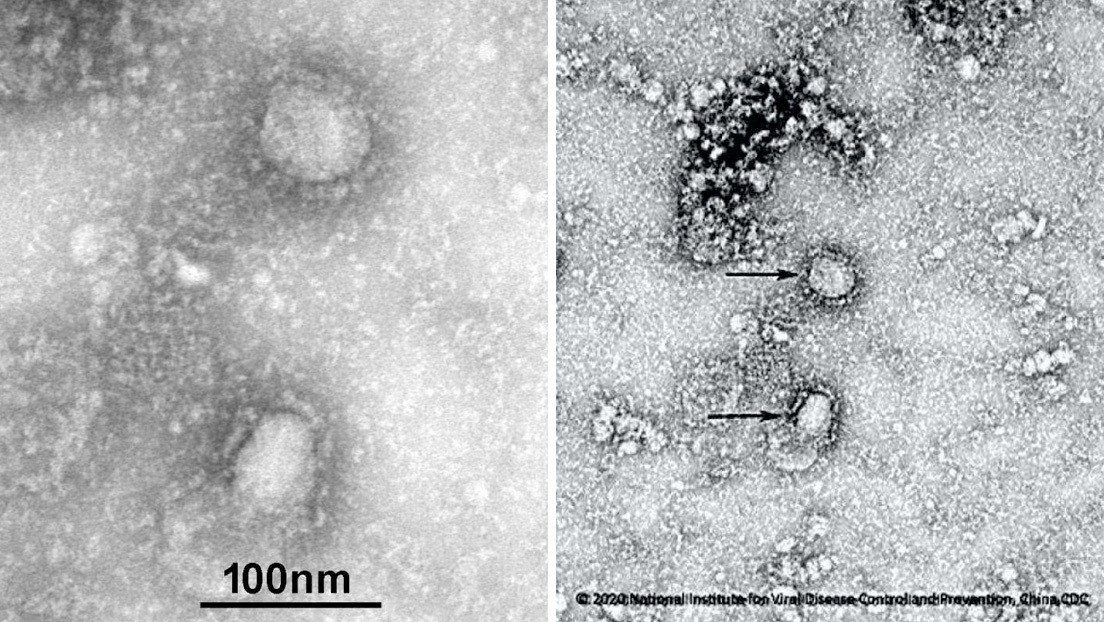 ParaMicroBio's tweet photo. #PMBnCoV Primeras imágenes del #virus de #Wuhan (#2019nCoV) al microscopio electrónico por el Instituto de Microbiología de la Academia de Ciencias de China.

#coronaviruschina #coronavirus  

Toda la actualidad en el blog.
https://t.co/maM068JCvR https://t.co/mA3zSFf6WE