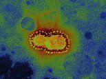 HealthMDoctor's tweet photo. US health experts predicted coronavirus could kill 65million peo => https://t.co/KVj6GfYqPo #health https://t.co/1Hoka9t7is
