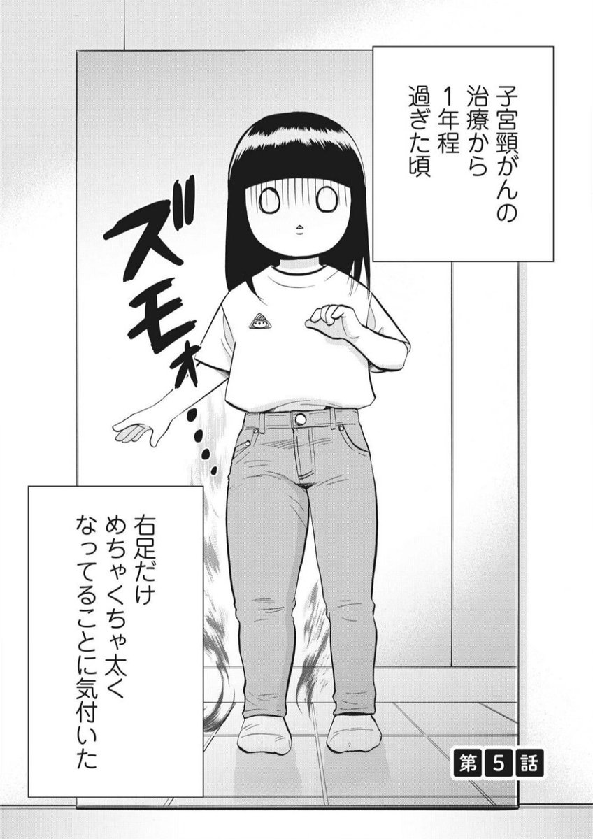 今月のさよしきゅそのあとは5、6話目が入ってます!ずっと描きたかったリンパ浮腫の話ですー!
さよならしきゅう そのあと プチキス(3) (Kissコミックス) 講談社  @amazonJPから 