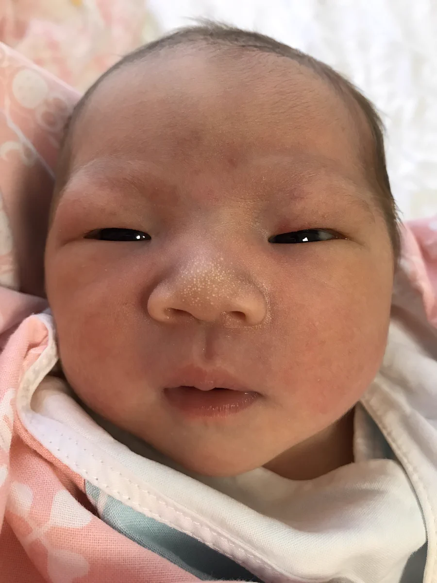 子どもの顔はすぐに変わっていくもの！！！赤ちゃんの時の顔は当てにならない・・・