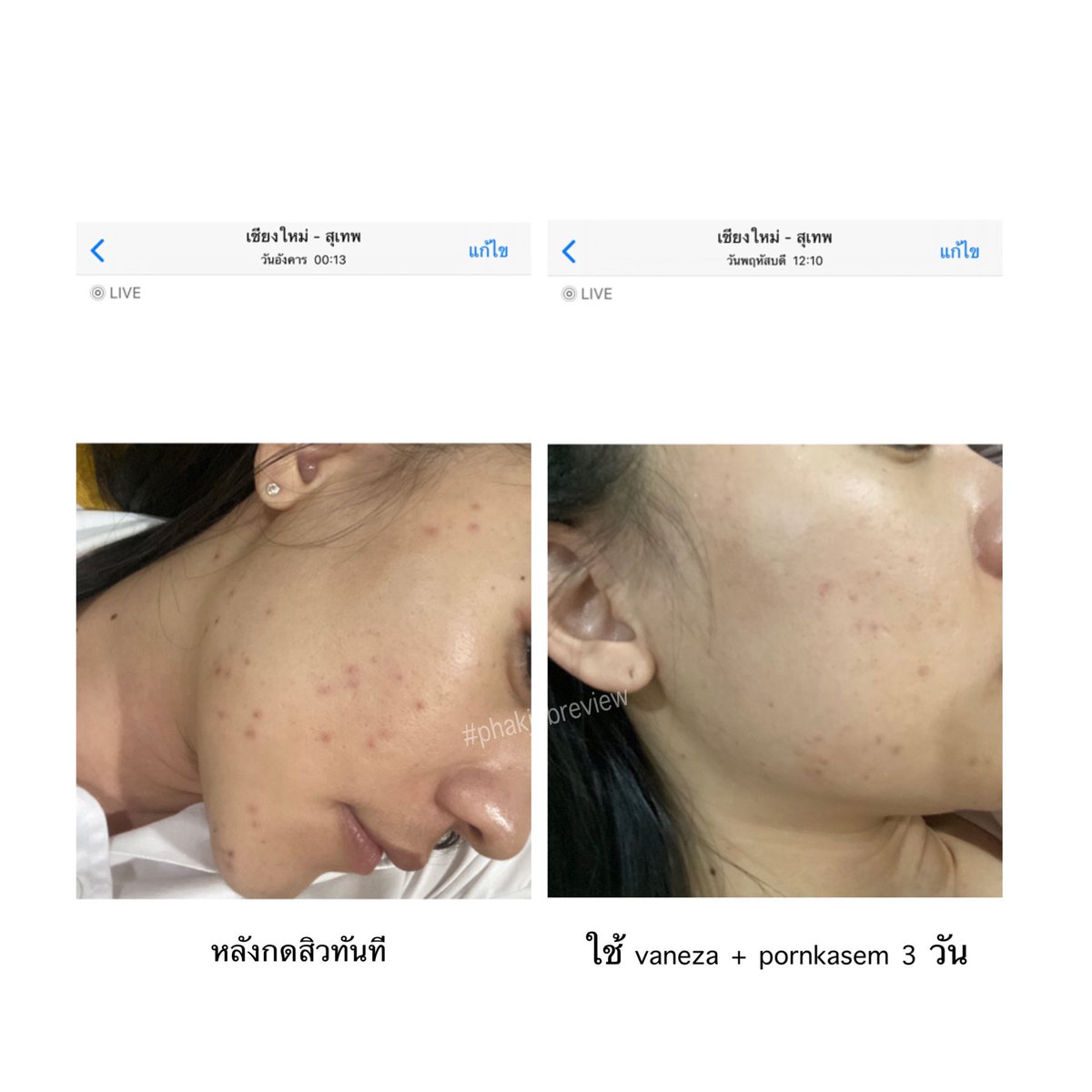 auntk12's tweet photo. รีวิวพลีชีพ หลังไปกดสิวมา 3 วัน
2 ตัวนี้คือดีย์มากก ตัว Vaneza ซึมลงผิวดีมากก รอยจางเร็ว หน้าขาวขึ้น เราใช้แทน Kiehl's ไปเลย ราคาไม่แรงส่วน พรเกษมช่วยเรื่องให้ความชุ่มชื้น อิ่มน้ำ เกลี่ยง่าย ซึมไว หน้าดูชุ่มชื้น เราทาเช้าเย็นเลยค่า  ไปตำเถอะ #ใช้ดีบอกต่อ #ไว้รีวิวห้ามขายของโว้ยย https://t.co/X5ffrp9EcP