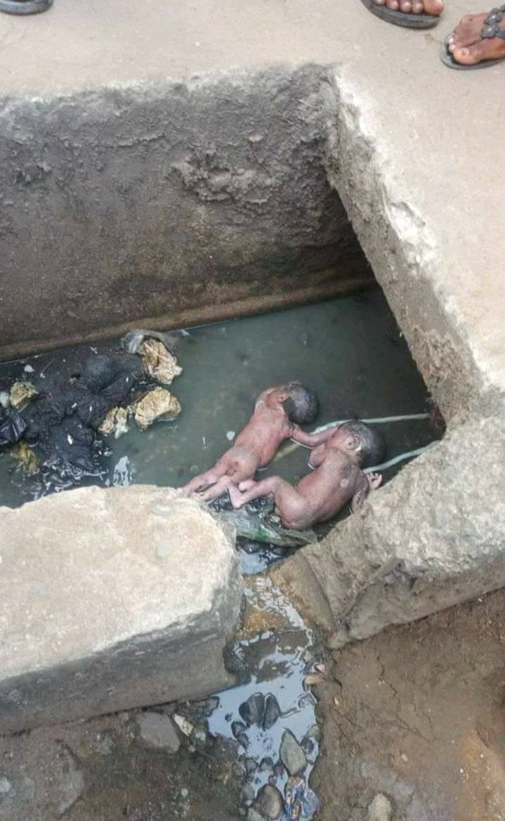 Gidi_Traffic's tweet image. "@sabrinaricky_: 1. Abortion is not killing babies, this is killing babies. 
2. Sex education does not promote teens to engage to sexual activity but it is to prevent this. 
3. This is not only the mother’s fault. The father is equally to blame.