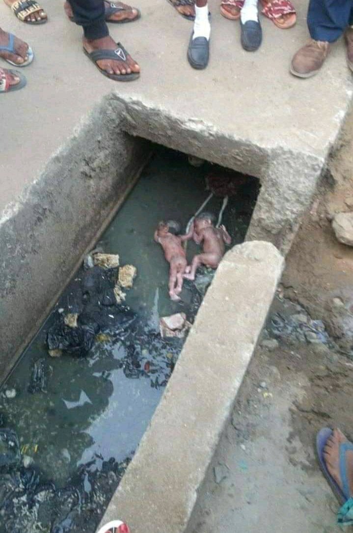 Gidi_Traffic's tweet image. "@sabrinaricky_: 1. Abortion is not killing babies, this is killing babies. 
2. Sex education does not promote teens to engage to sexual activity but it is to prevent this. 
3. This is not only the mother’s fault. The father is equally to blame.