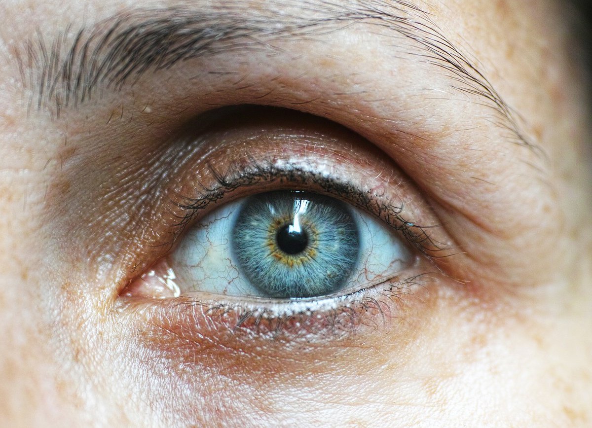 HPS_Hospitales's tweet photo. 👁 Ojeras y bolsas, ¿se pueden eliminar? 👉 Es uno de los motivos de consulta más frecuentes en #Oculoplastia
💢 Generan expresión de fatiga o cansancio permanente, y sí, se pueden eliminar.
https://t.co/6dzQqnyTj8
#Oftalmología #HPSInforma #FelizFinde #ojeras https://t.co/pEf8xEdoGl