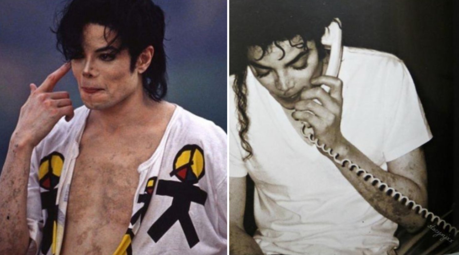 Michael Jackson Vitiligo Hands michael-jackson-vitiligo-hands