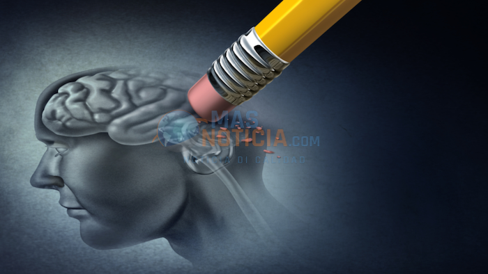 masnoticia's tweet photo. #Lifestyle Si bo drumi malo, bo tin mas posibilidad di tin Alzheimer segun estudio https://t.co/jlUlagOQZS https://t.co/EBGwr8QUMZ