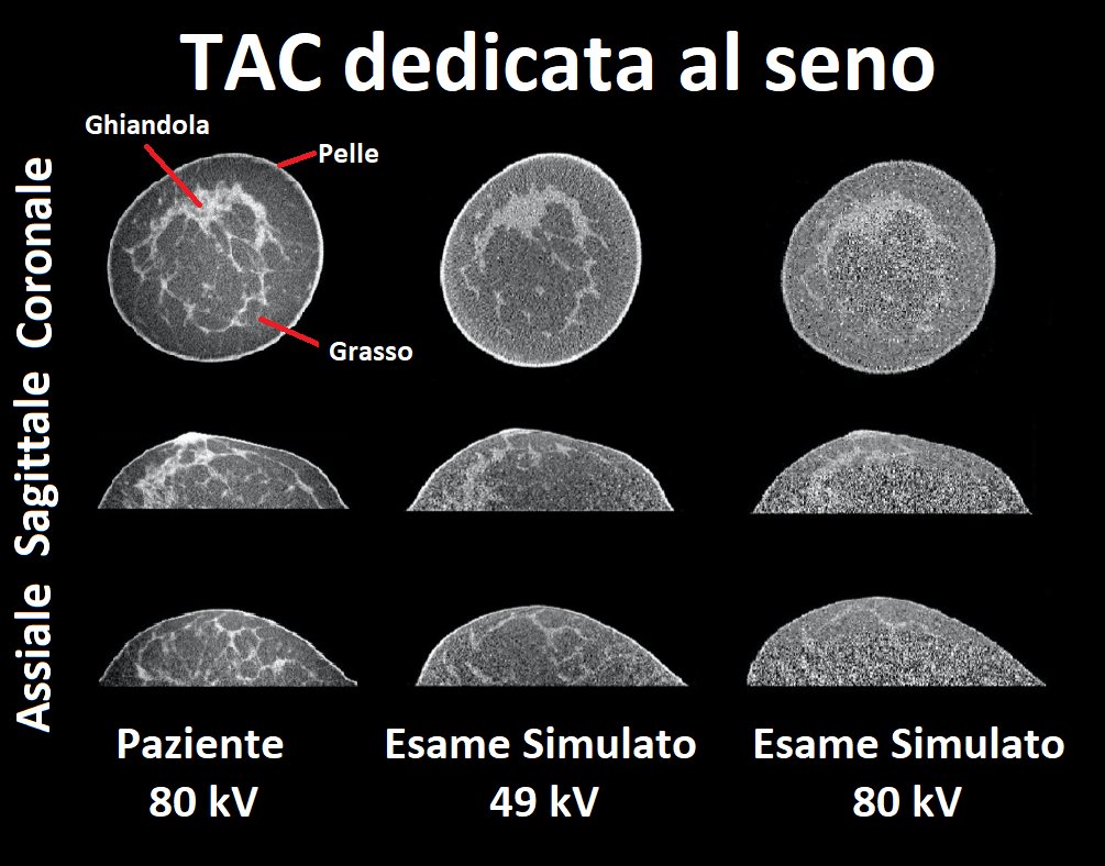 Antonio Sarno è tra i vincitori del Grant Giovani <a href="/INFN_/">INFN</a> che mira a sostenere il lavoro di giovani ricercatori.
Il suo progetto ha lo scopo di sviluppare una piattaforma per la realizzazione di test per apparati dedicati alla diagnosi del cancro al seno
bit.ly/2TY797E