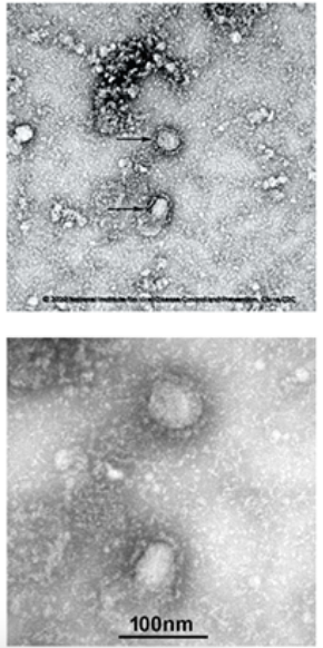 microBIOblog's tweet photo. Aquí está, el primer "selfi" del #coronavirus de Wuhan #2019nCoV. Sigue a tiempo real la epidemia en el blog microBIO 👉 https://t.co/ois8VumKZN

https://t.co/5sKogNqvfP https://t.co/loVRk1ulRf
