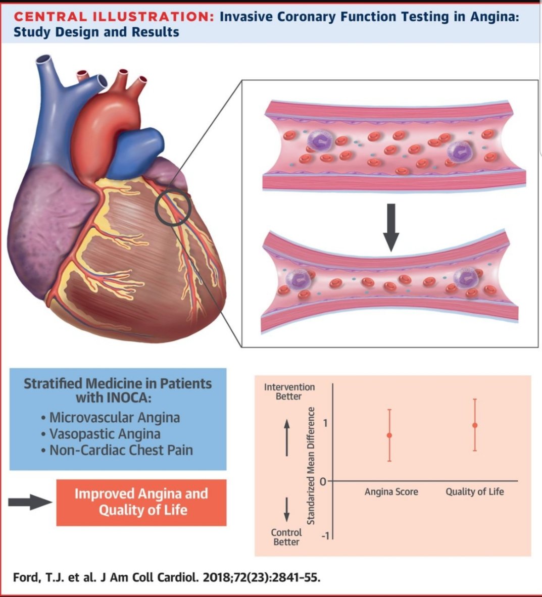 Michel_CorbanMD's tweet photo. Helping #CMD patients starts by setting the record straight:
1- #CMD is *NOT* a benign condition: Angina, MACE, HFpEF. + systemic disease 👇
2- RCT #CorMica showed that diagnosis AND treatment *DO* improve angina and quality of life in vasospastic and microvascular angina 👇 https://t.co/4m2rDOkFcy