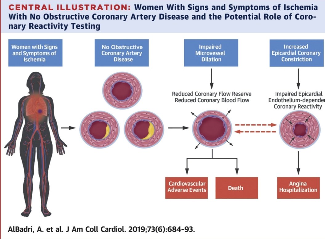 Michel_CorbanMD's tweet photo. Helping #CMD patients starts by setting the record straight:
1- #CMD is *NOT* a benign condition: Angina, MACE, HFpEF. + systemic disease 👇
2- RCT #CorMica showed that diagnosis AND treatment *DO* improve angina and quality of life in vasospastic and microvascular angina 👇 https://t.co/4m2rDOkFcy