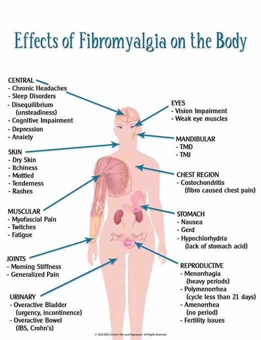 #Incurable, #debilitating, #uncontrollable #invisibleillness https://t.co/1P5Cr9SiVZ<a href="/tag/incurable"class="tags">#Incurable</a><a href="/tag/debilitating"class="tags">#debilitating</a><a href="/tag/uncontrollable"class="tags">#uncontrollable</a><a href="/tag/invisibleillness"class="tags">#invisibleillness</a>
