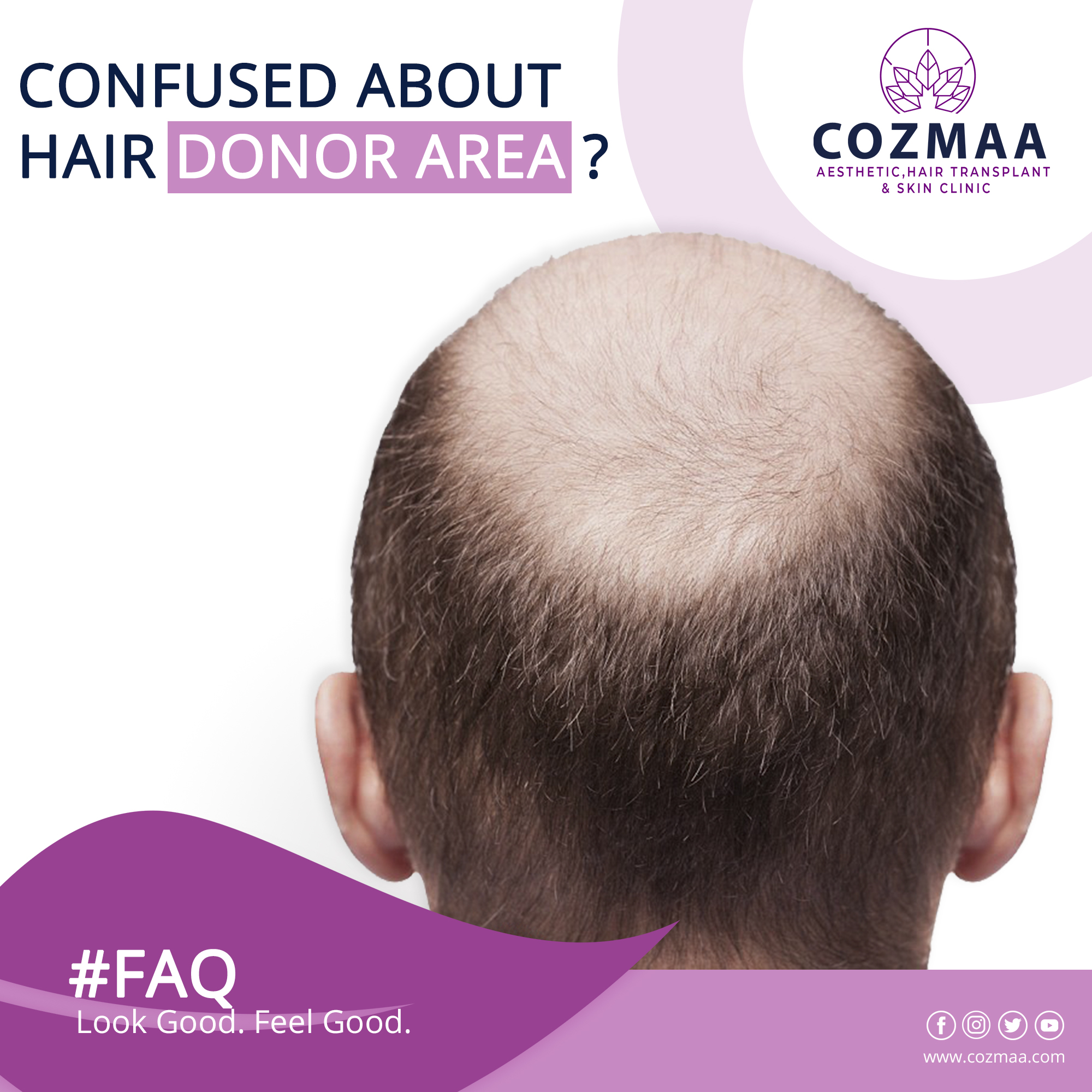 Cozmaa - Aesthetic, Hair Transplant & Skin Clinic on Twitter: Cozmaa - Aesthetic, Hair Transplant & Skin Clinic on Twitter: