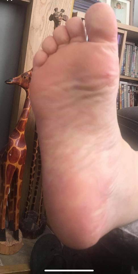 Call Gemma on  07908 090228 to arrange your appointment.
Mon-Fri some evening and weekend appointments 
#chichester #eastwittering #westwittering #bognor #birdham #foothealth #feet #bracklesham #oving #Selsey #happyfeet #feetproblems #bognor #itchenor #chiropodist #podiatry