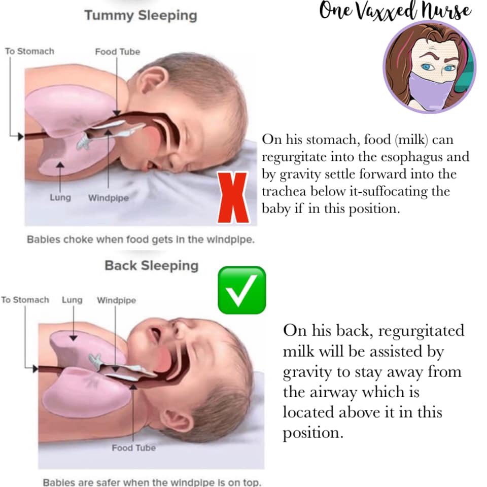onevaxxednurse's tweet image. Aside from an unsafe sleep environment (soft surface, blankets, pillows and the presence of another body), sleep position plays a huge role in the asphyxiation deaths of infants. Here’s how: 
#vaccinesdontcauseSIDS #backtosleep