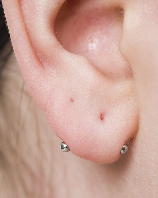 SkinDTattoo's tweet photo. Here is something a little different. This is a healed #horizontallobe #piercing that our resident piercer Claire did afew years ago. #winnipegpiercer #alsodoesbabyears #infantearpiercing #babyearpiercing #bodypiercing #winnipegbodypiercer #corydonave #theprincessroom https://t.co/SzKM4tJ9Ox