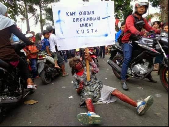 superradioid's tweet photo. Pentingnya Pelibatan Masyarakat Dalam Sosialisasi Kusta #Diskriminasi #KetuaLinksos #kusta #Linkarsosialindonesia #Linksos #Sosialisasikusta https://t.co/CR18h1sWBX https://t.co/qaBrAZUwRs