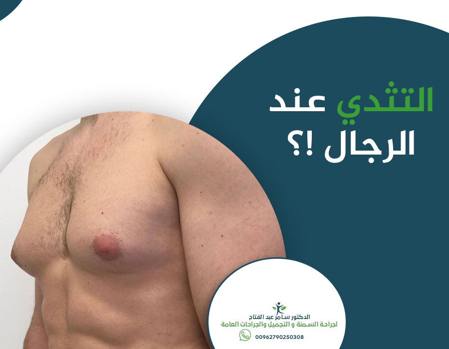 تشكل حالة #تثدي_الرجل نحو 60%من المشاكل المتعلقة #بالثديين لدى #الرجال و85%من حالات الكتل في #الثديين لدى #الرجال.
ظهور هذه الحالة ليس محدودا في سن معينة، إذ قد تظهر في أية مرحلة #عمرية، إلا إن 40%من الحالات تظهر عند #الفتيان ما بين سن الـ14 حتى 15.5، على خلفية #هرمونية.