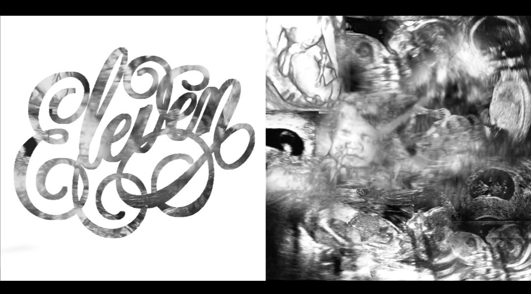 Unfruitful13's tweet photo. #34w6d My DH made this beautiful collage of some of our scan pictures so far. So hard to believe we have got this far. Of the 11 embryos transferred back into my body she has made it the furthest #Embryo11 #pregnancyafterloss #5weekstogo #IVF #ICSI #IMSI #PICSI #6yearsTTC https://t.co/WYQQvHN2tY