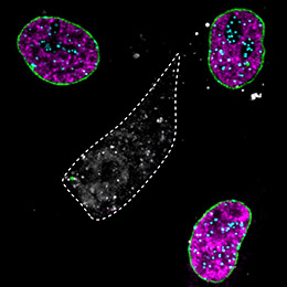 In the middle cell (grey), three different proteins were specifically removed: a protein of the nuclear envelope (Lamin A, green), a chromatin protein (CENPA, turquoise) and the replication protein (PCNA, magenta).
